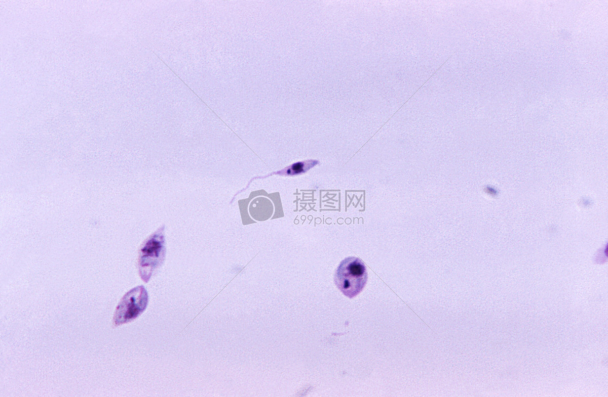 此显微照片,发现了一些leptomonad上演,即前鞭毛虫,利什曼原虫属的