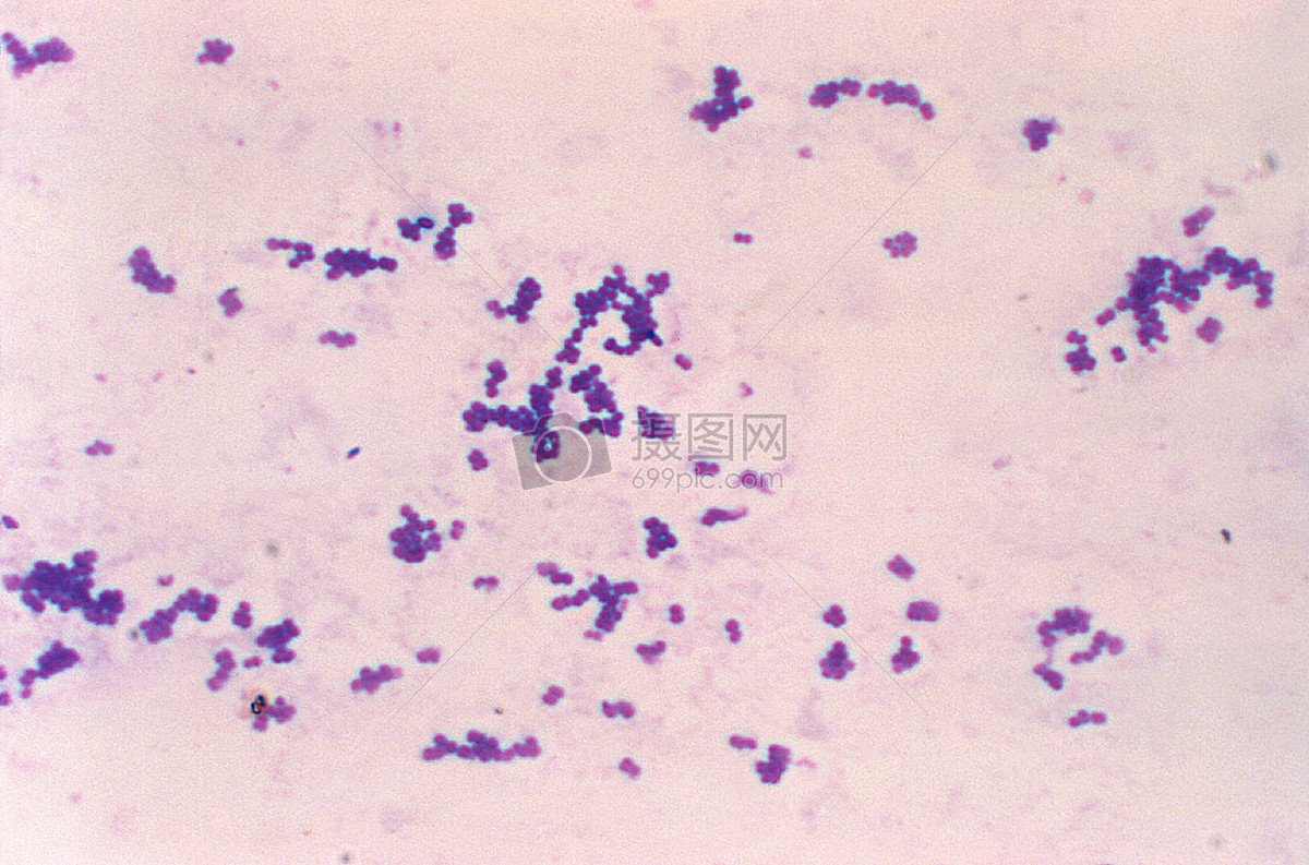 aerococcus种.革兰氏染色.