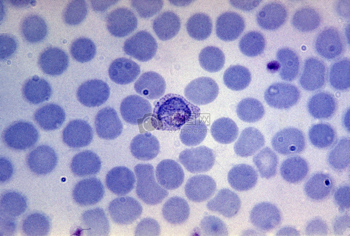 血涂片显示疟原虫生长滋养体.寄生物