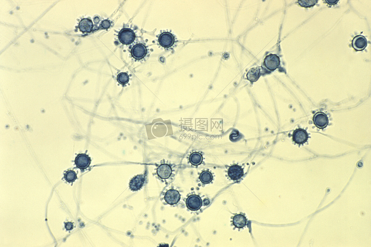 在400x的放大,这种显微照片显示了一些由荚膜组织胞浆菌的真菌所显示