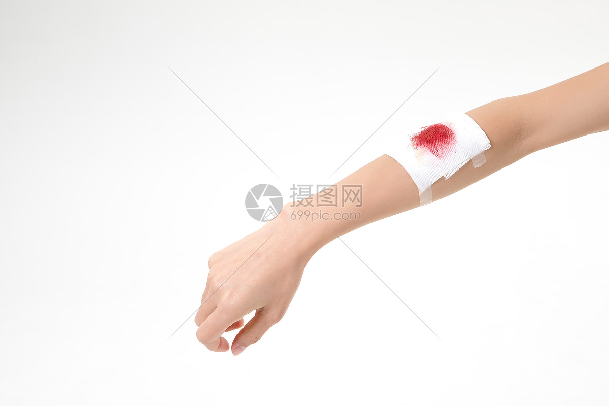 手臂受伤包扎