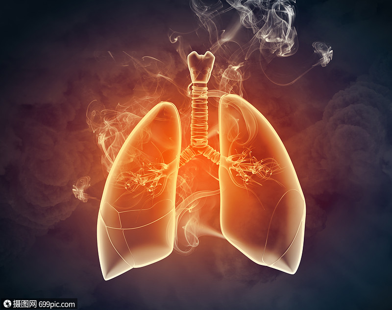 人类肺的示意图彩色背景上同元素的人类肺的示意图拼贴喉解剖学