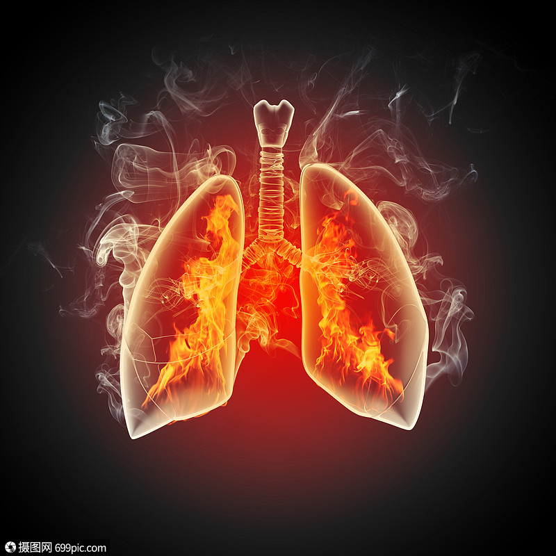 人类肺的示意图彩色背景上同元素的人类肺的示意图拼贴解剖疼痛