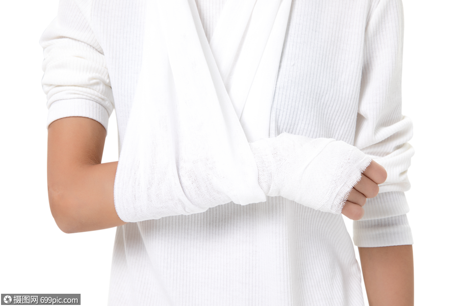 手臂骨折脱臼受伤患者