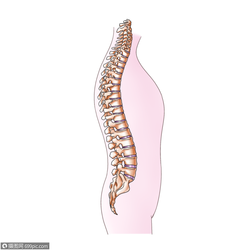 脊柱侧面